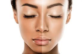 Pigmentation